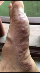 Chữa trị các bệnh da tại Quảng Nam