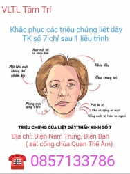 Trị Liệt Dây TK Số 7 Với VLTL Tâm Trí tại Quảng Nam