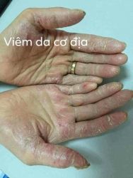 c vấn đề ngoài da sau đây? tại Quảng Nam