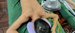 Châm cứu và vật lý trị liệu tại Quảng Nam