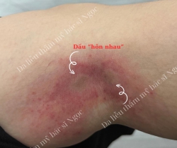 Da Liễu Thẩm Mỹ Bác sĩ Ngọc tại Quảng Nam