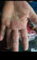 Nhà mình Ai còn bị như hình mà chưa biết cách trị thì ib mình bày cho nha tại Quảng Nam