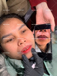 Thâm cỡ nào cũng bay được nhé!Chào ngày mới bằng đôi môi Khử thâm công nghệ nano không kí tại Quảng Nam