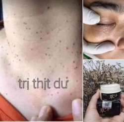 Em để cho mỗi Bác chỉ 1 lọ để trải nghiệm sự hiệu quả của Sản phẩm tại Quảng Nam