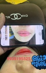 Trả da ca môi sau khi làm kĩ thuật nano không kích ứng tại spa tại Quảng Nam