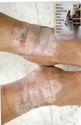 Khỏi vĩnh cương tại Quảng Nam