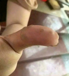  chân tại Quảng Nam