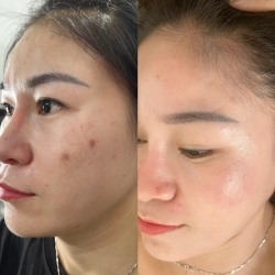 Cô LANA nguyễn: Giàng viền trường công Nghệ Y Dược Việt Nam tại Quảng Nam